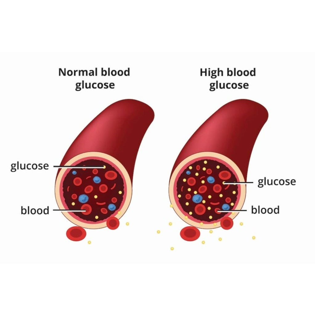 Moringa on Diabetes Mgt without Side Effect