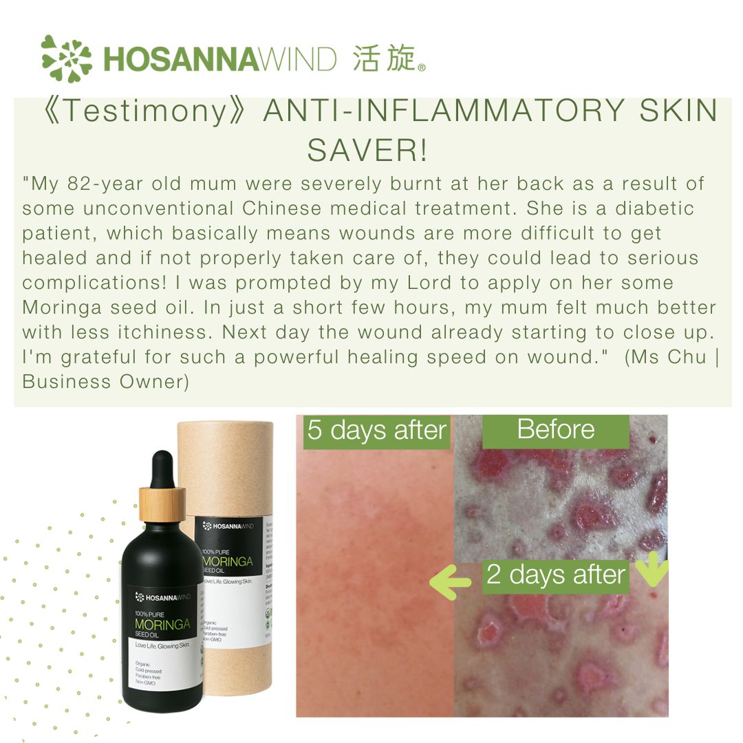 HOSANNAWIND MORINGA SEED OIL 100mL