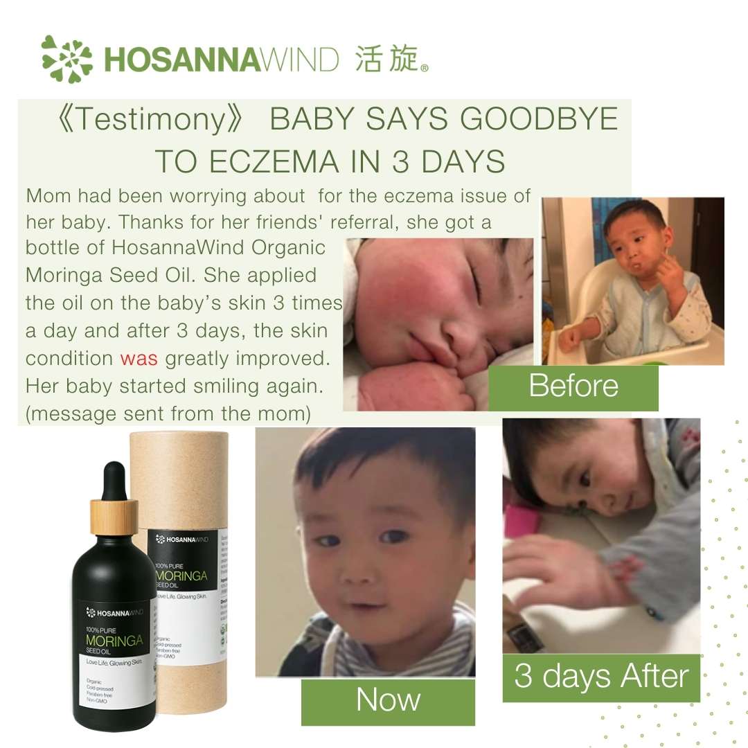 HOSANNAWIND MORINGA SEED OIL 30mL