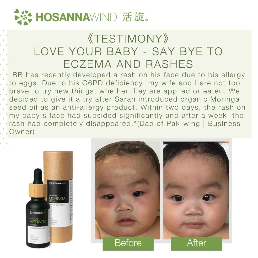 HOSANNAWIND MORINGA SEED OIL 3mL