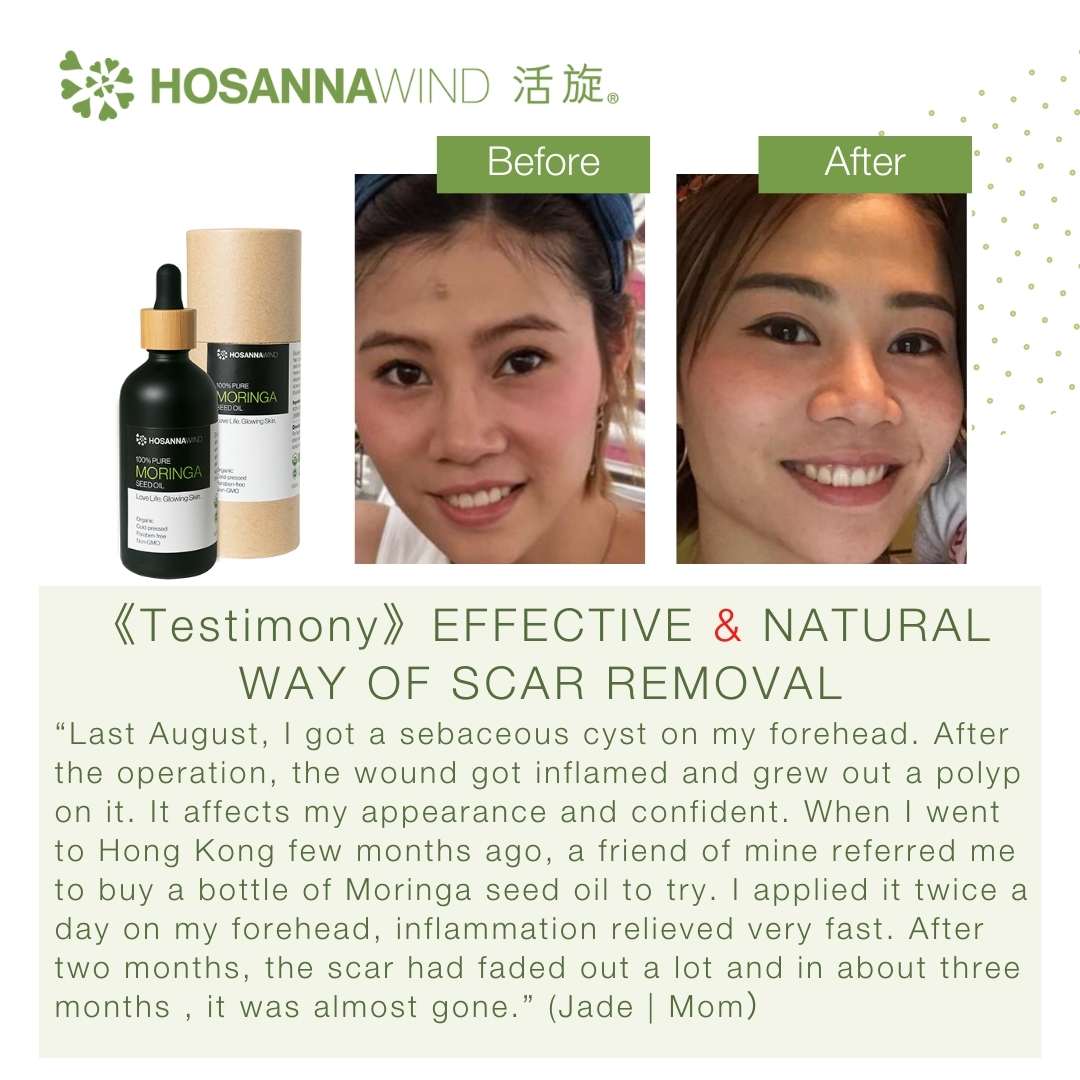 HOSANNAWIND MORINGA SEED OIL 3mL