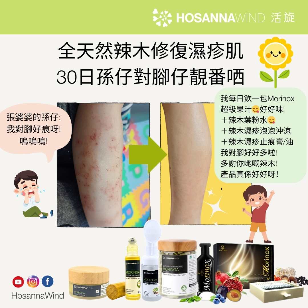 HOSANNAWIND MORINGA ECZEMA CLEANSING FOAM