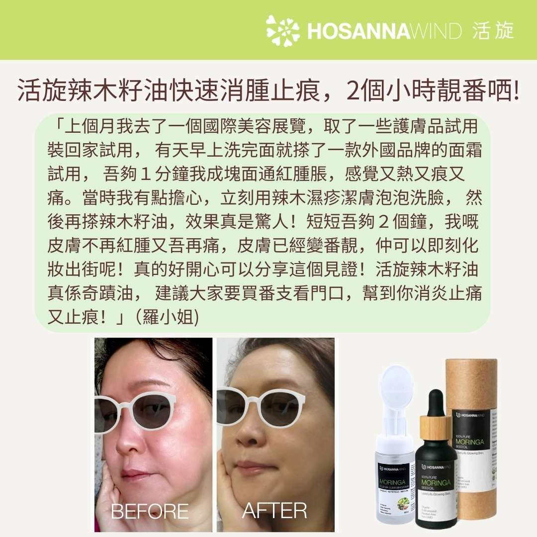 HOSANNAWIND MORINGA ECZEMA CLEANSING FOAM