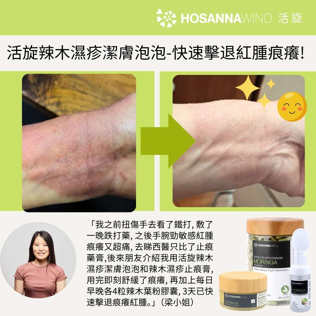 HOSANNAWIND MORINGA ECZEMA CLEANSING FOAM