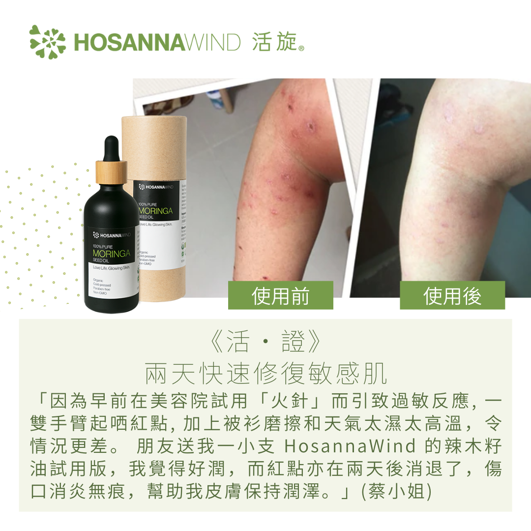 HOSANNAWIND MORINGA SEED OIL  10mL