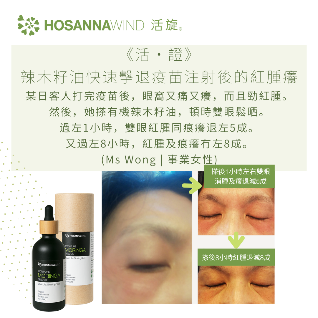 HOSANNAWIND MORINGA SEED OIL  10mL