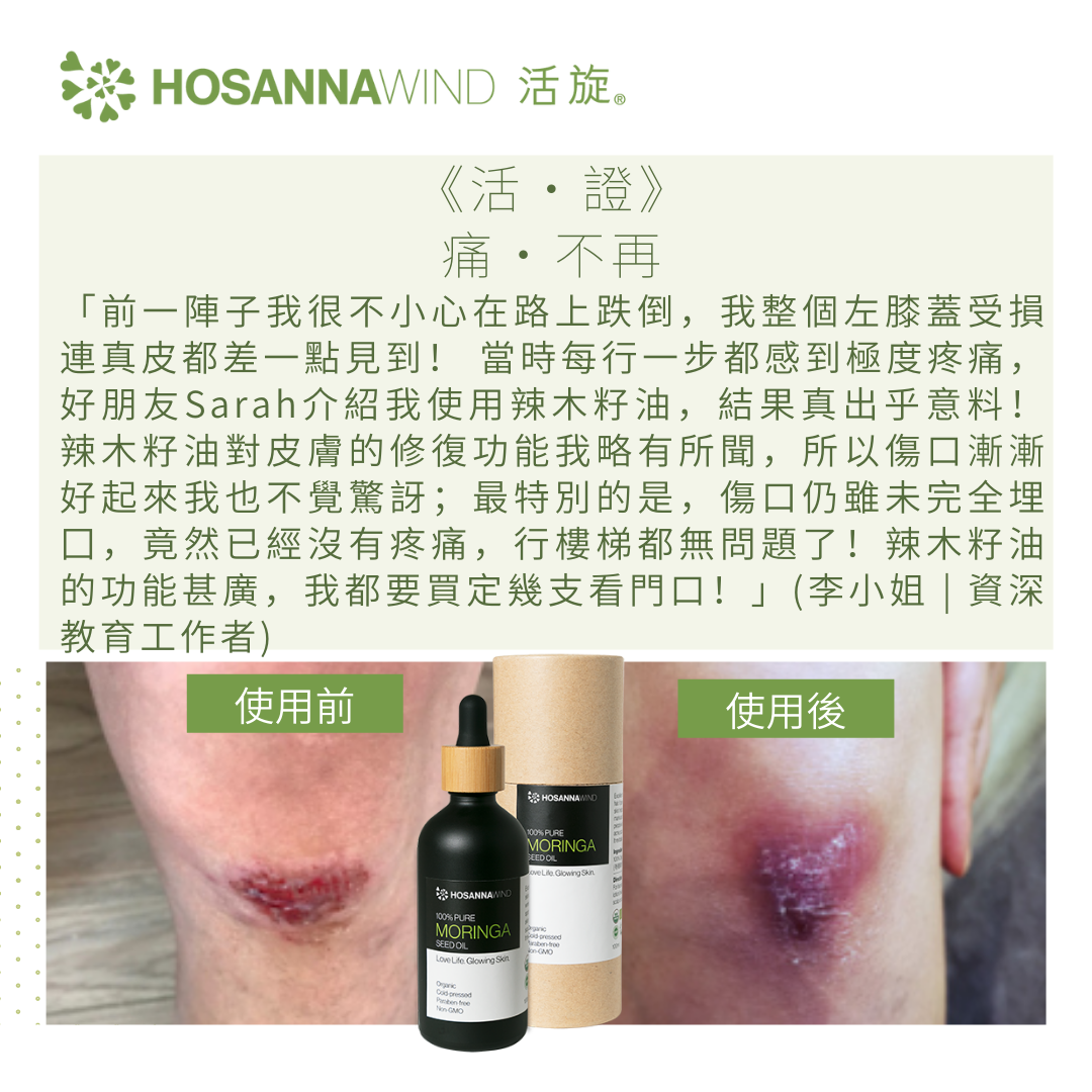 HOSANNAWIND MORINGA SEED OIL  10mL