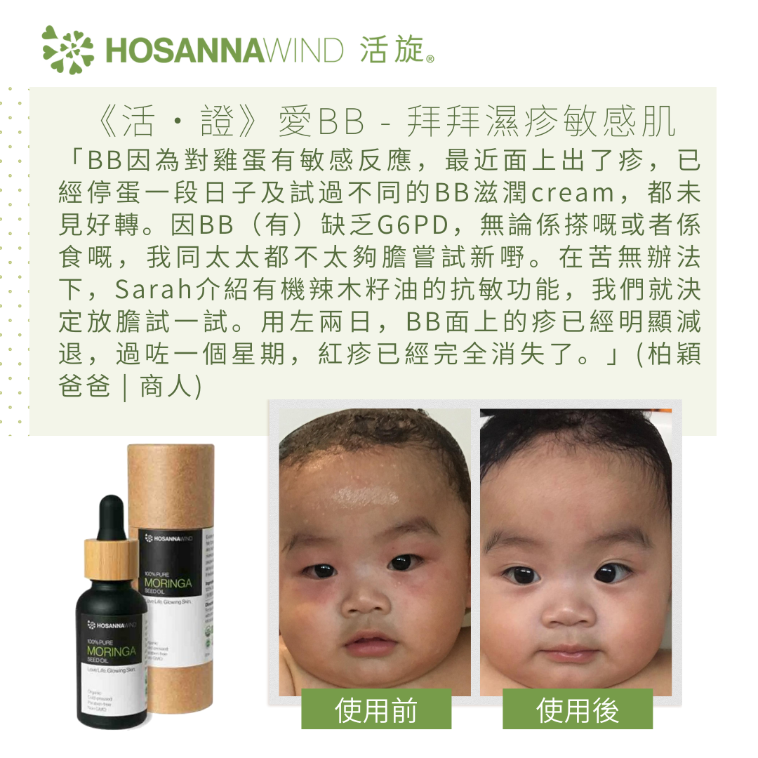 HOSANNAWIND MORINGA SEED OIL  10mL